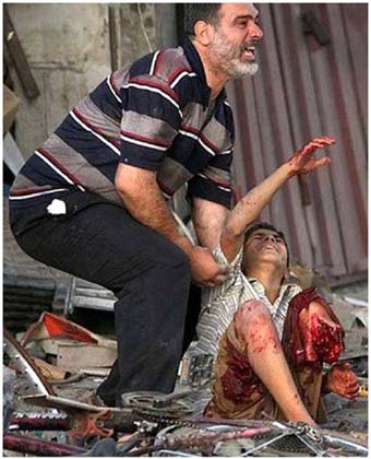Ferito Guerra di Gaza