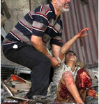 Ferito Guerra di Gaza
